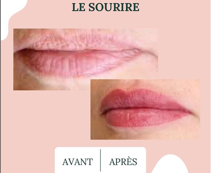 avant-apres-04