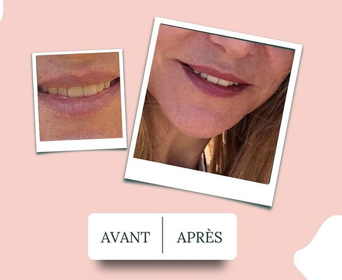 avant-apres-faire-face-01