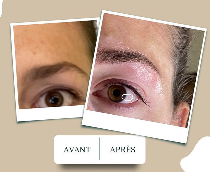 avant-apres-faire-face-02