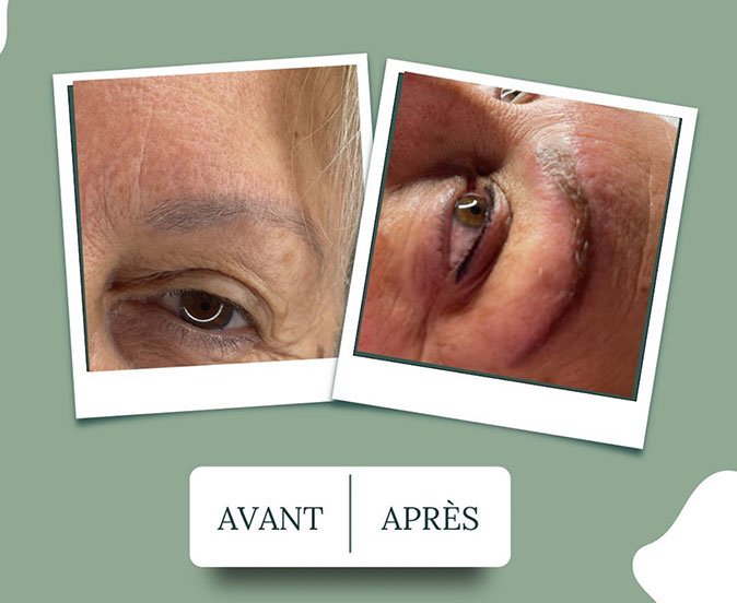 avant-apres-faire-face-03