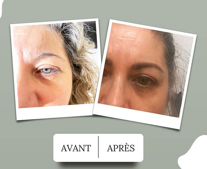 avant-apres-faire-face-04