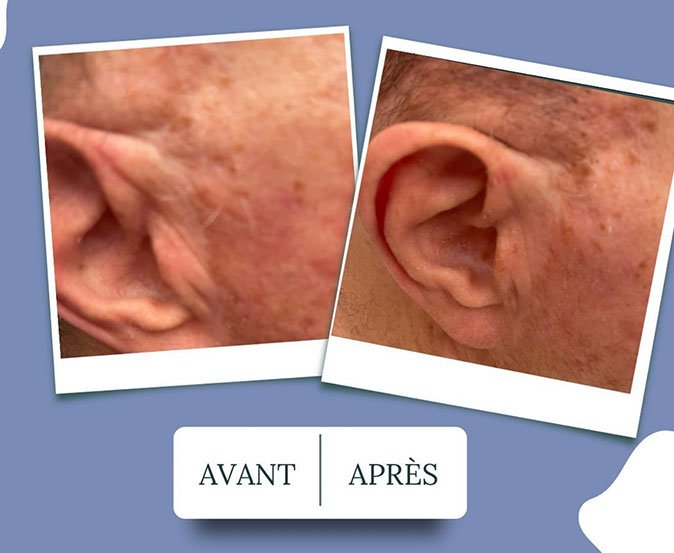 avant-apres-faire-face-05