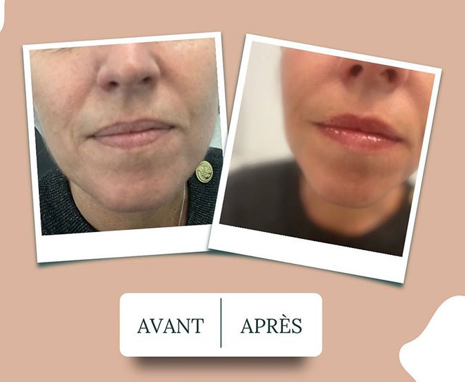 avant-apres-faire-face-06