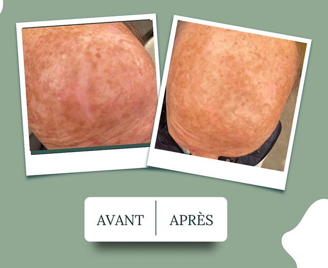 avant-apres-faire-face-07