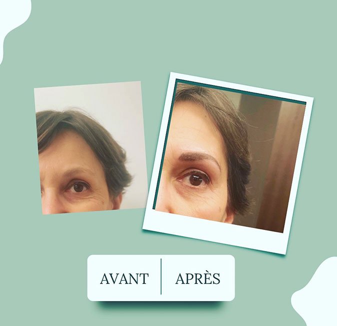 avant-apres-faire-face-08